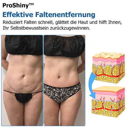 Letzter Tag 55% Rabatt✨ProShiny™ Kompression Körperformung Set